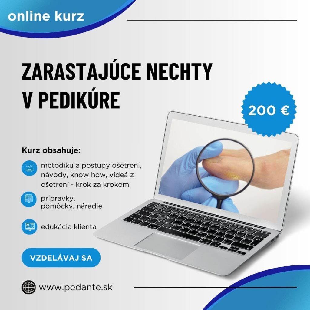zarastajuce nechty v pedikure